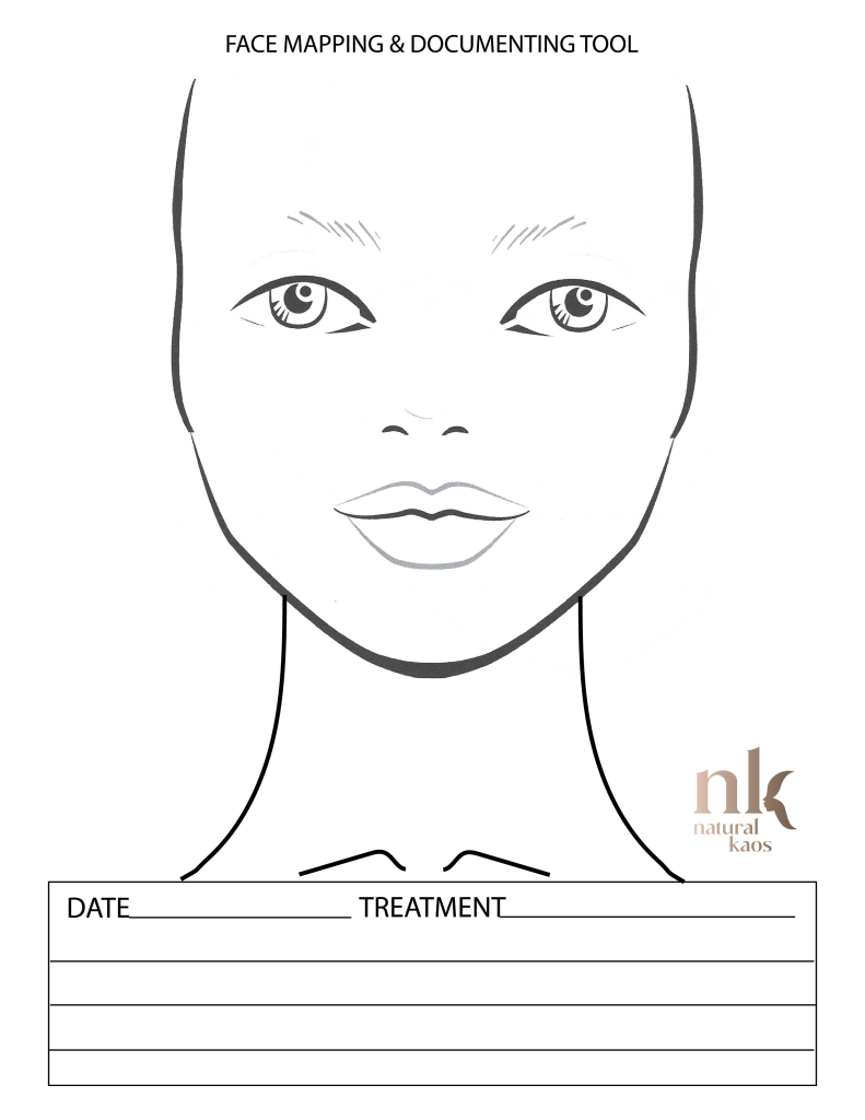 printable botox face map