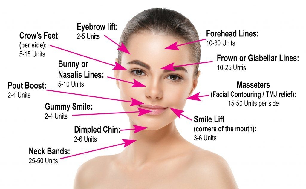 Printable Botox Face Map